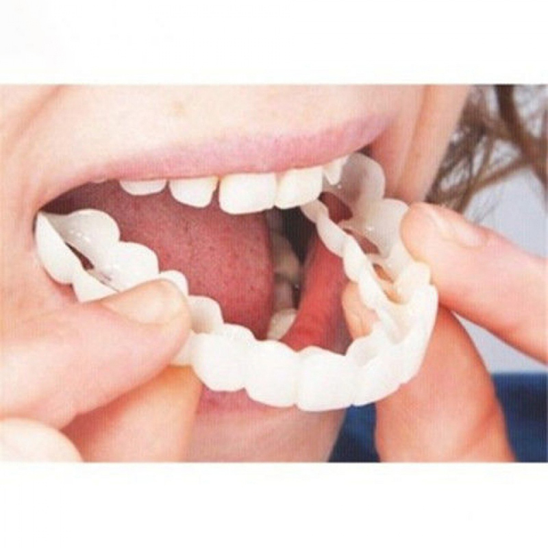 Teeth Whitening Veneers - Perfect Fit Valse Tanden Cover Whitening