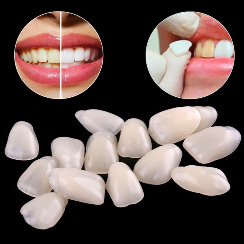 Teeth Whitening Veneers - Tijdelijke tandheelkundige fineer - Ultradunne harstaandhoezen