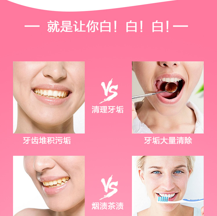 Thailand RASYAN Kruiden Kruidn - Teeth Whitening In Thailand recensie en prijs
