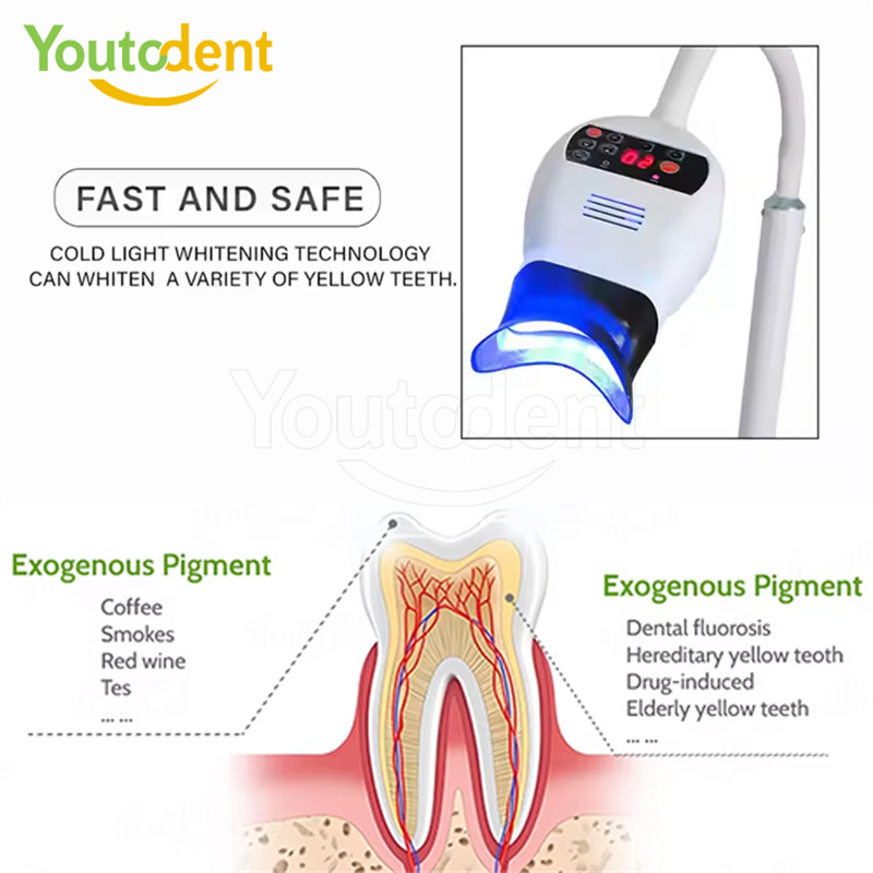 Professionele Tandheelkundige  - Teeth Whitening Kit With Light recensie en prijs