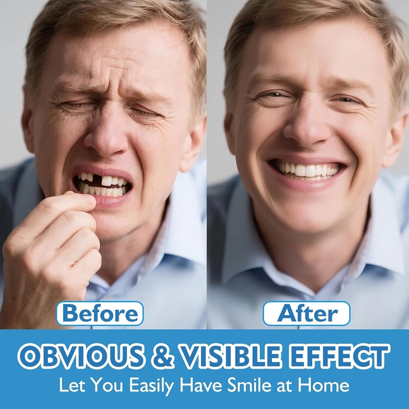 Volledige set siliconen gebits - Teeth Whitening Mask recensie en prijs