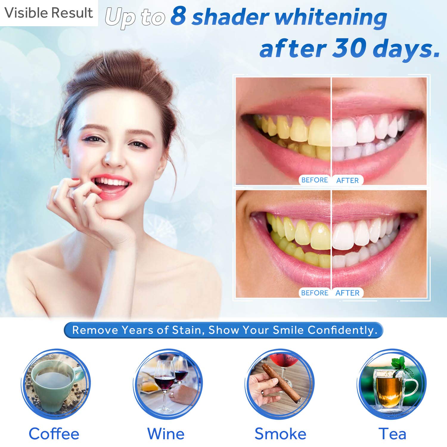 Tanden Whitening Gel Refill Sp - Teeth Whitening Gel recensie en prijs