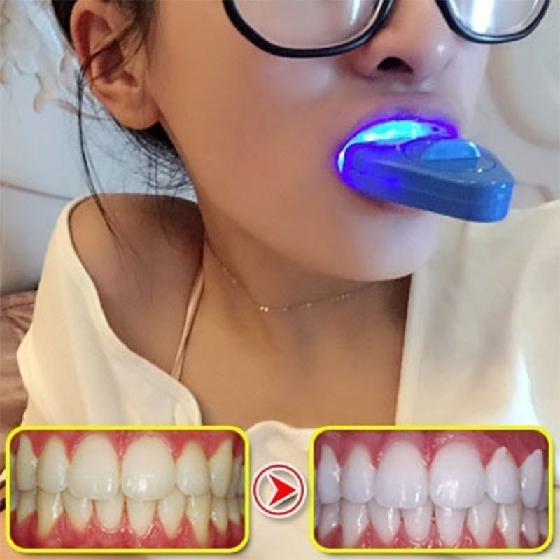LED Tanden Whitening Licht Whi - Teeth Whitening Uv Kit recensie en prijs