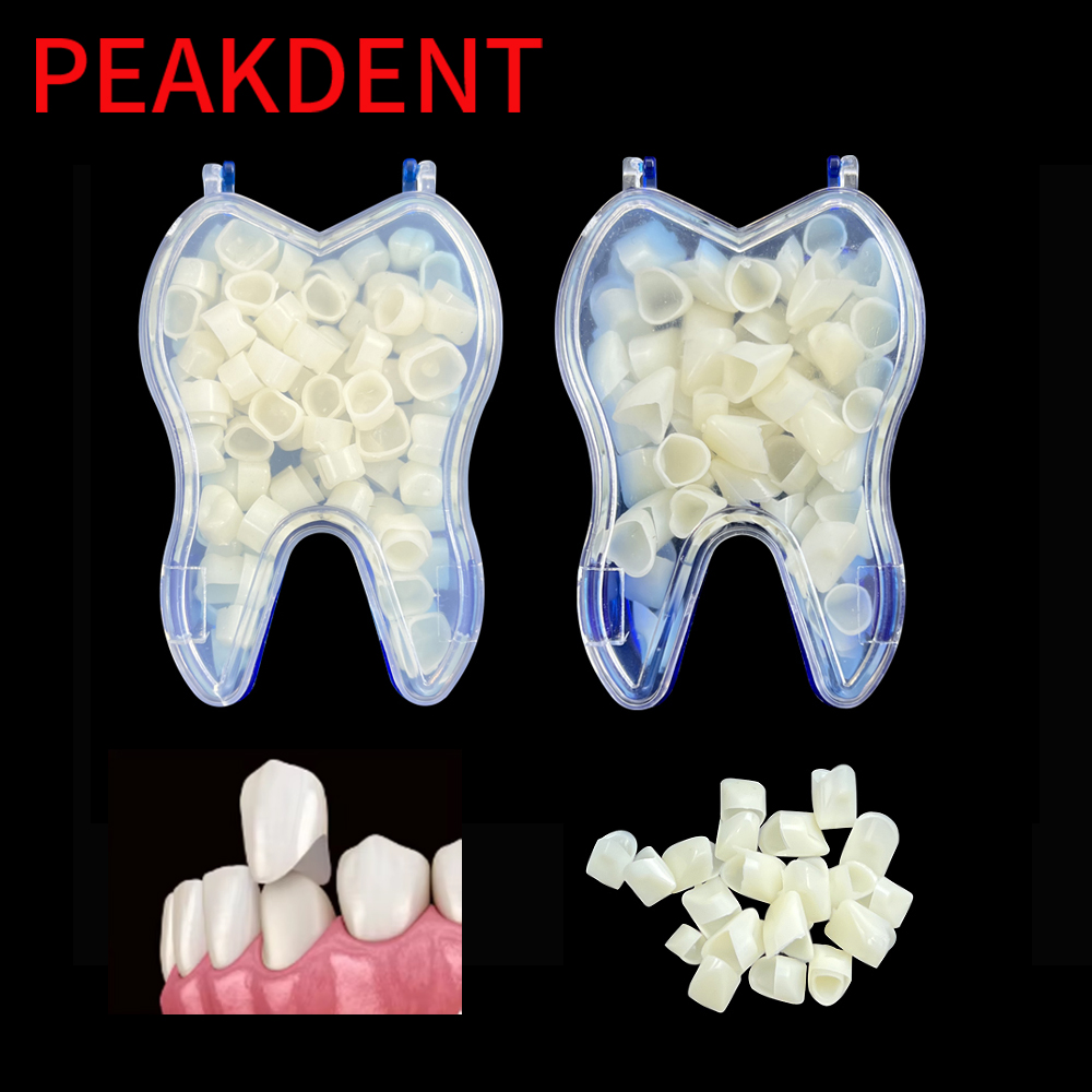 Tandheelkundige tijdelijke kro - Teeth Whitening Veneers recensie en prijs