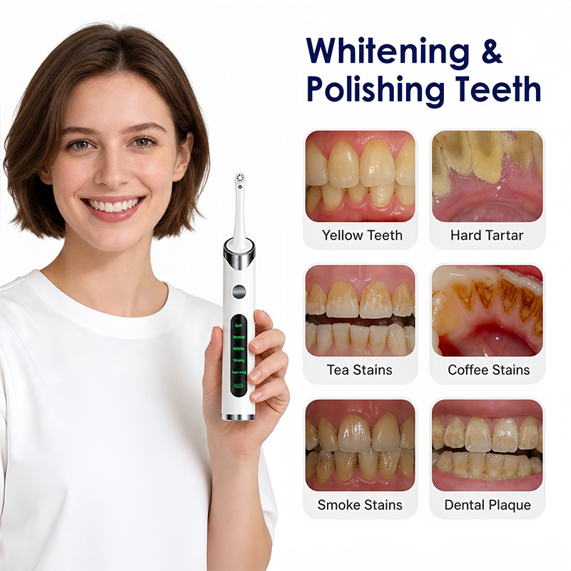 Tandenpolijster Tandenbleekset - Teeth Whitening Kit With Light recensie en prijs