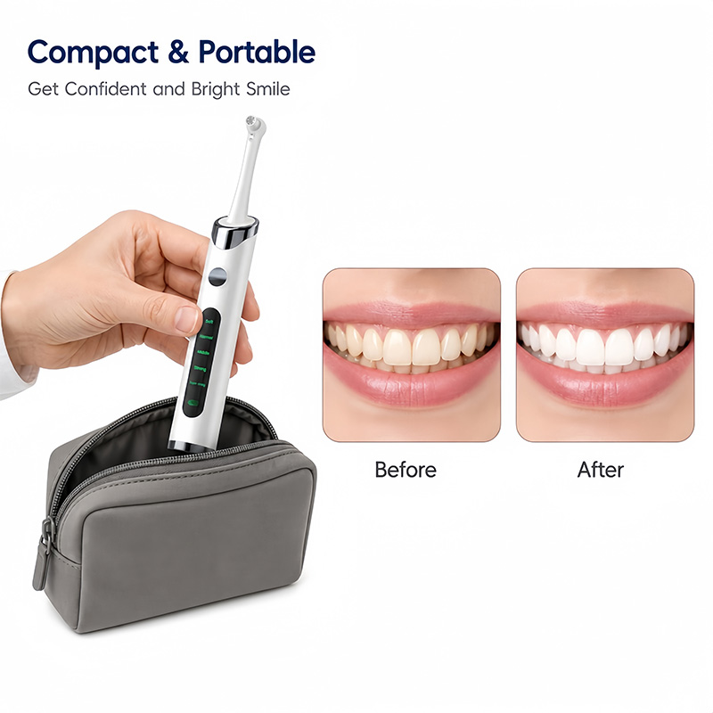 Tandenpolijster Tandenbleekset - Teeth Whitening Kit With Light recensie en prijs