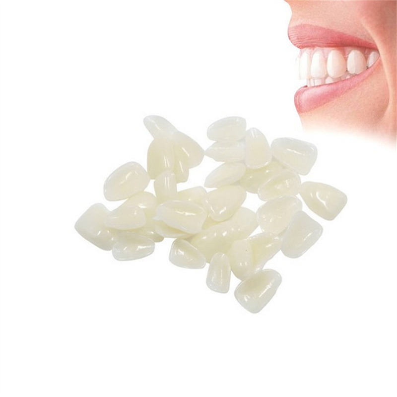 Tijdelijke tandheelkundige fin - Teeth Whitening Veneers recensie en prijs