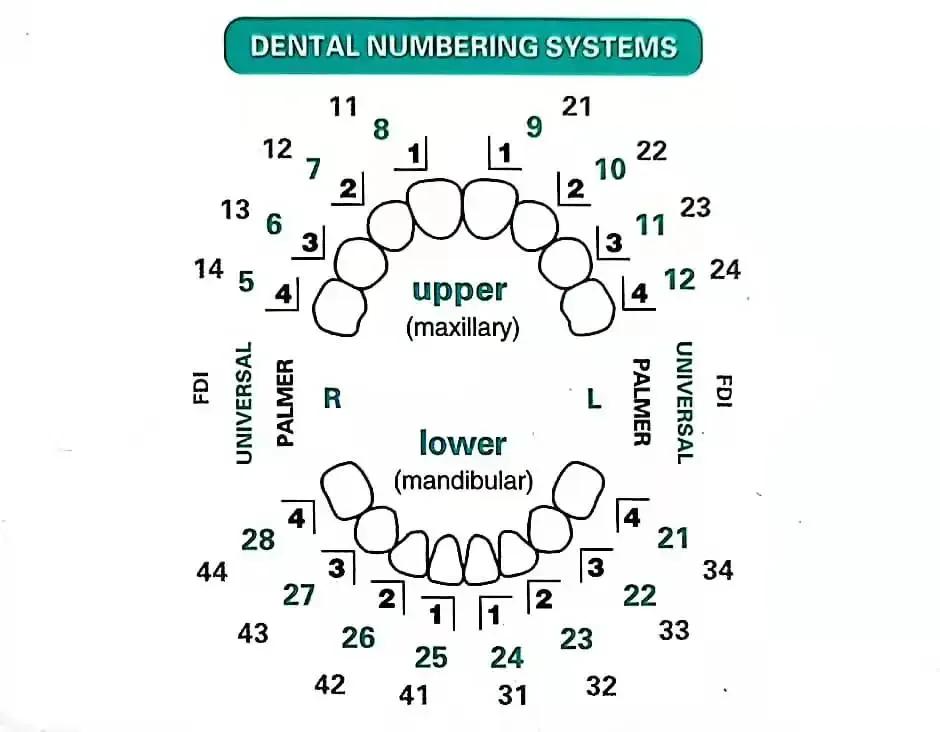 Tandheelkundige mal voor compo - Teeth Whitening Veneers recensie en prijs
