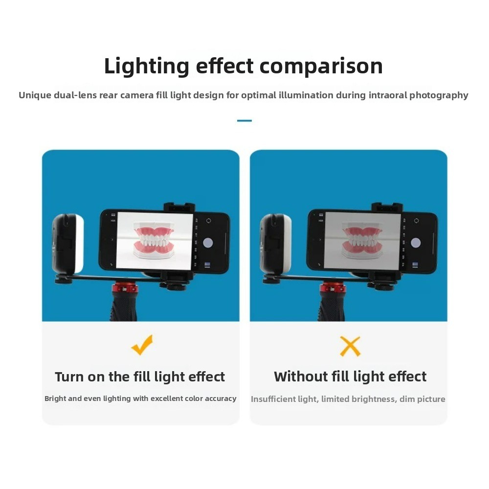 Tandheelkundige fotografielamp - Teeth Whitening Kit With Light recensie en prijs