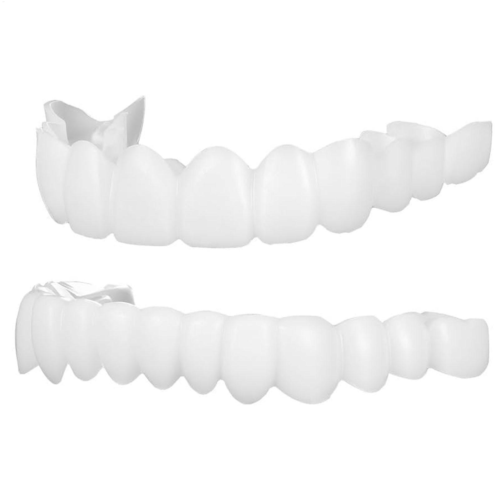 1 paar SnapsOn Tanden Facings  - Teeth Whitening Mask recensie en prijs