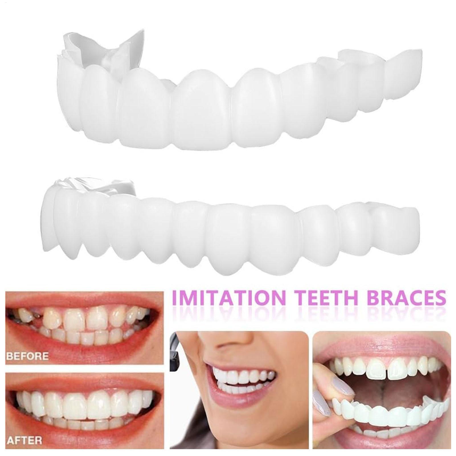 1 paar SnapsOn Tanden Facings  - Teeth Whitening Mask recensie en prijs