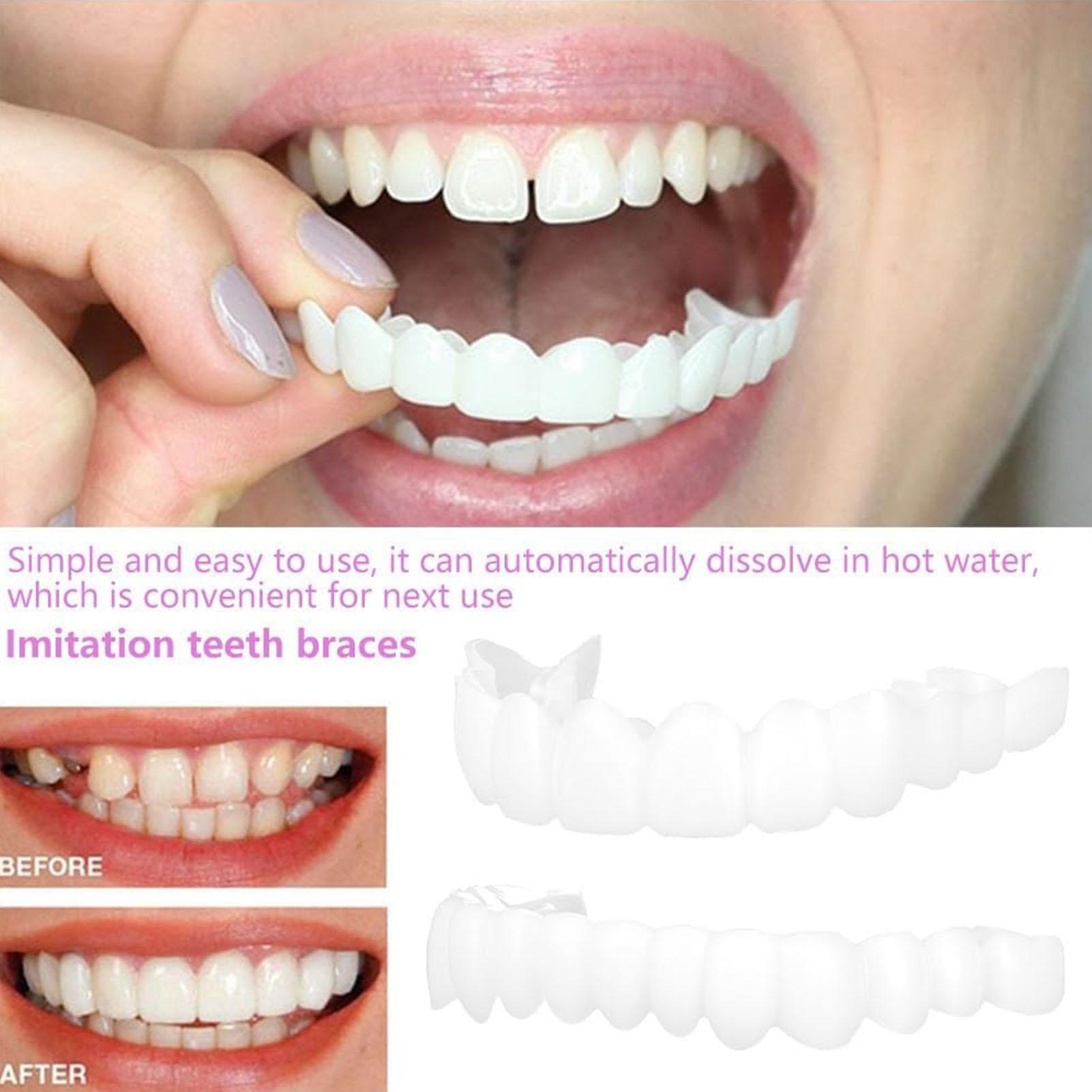 1 paar SnapsOn Tanden Facings  - Teeth Whitening Mask recensie en prijs
