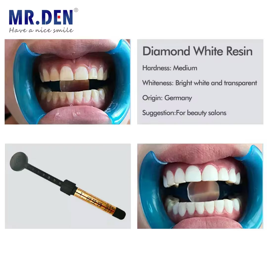 Nano-Emaille Veneer Materiaal  - Teeth Whitening Veneers recensie en prijs