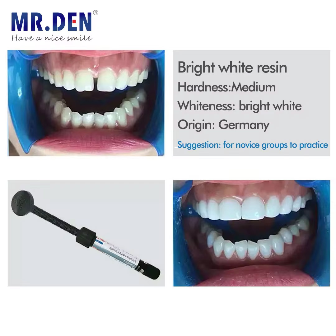 Nano-Emaille Veneer Materiaal  - Teeth Whitening Veneers recensie en prijs