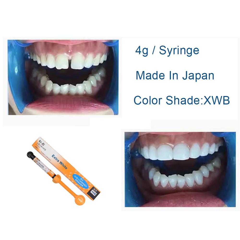 Tandheelkundige composiet hars - Teeth Whitening Veneers recensie en prijs