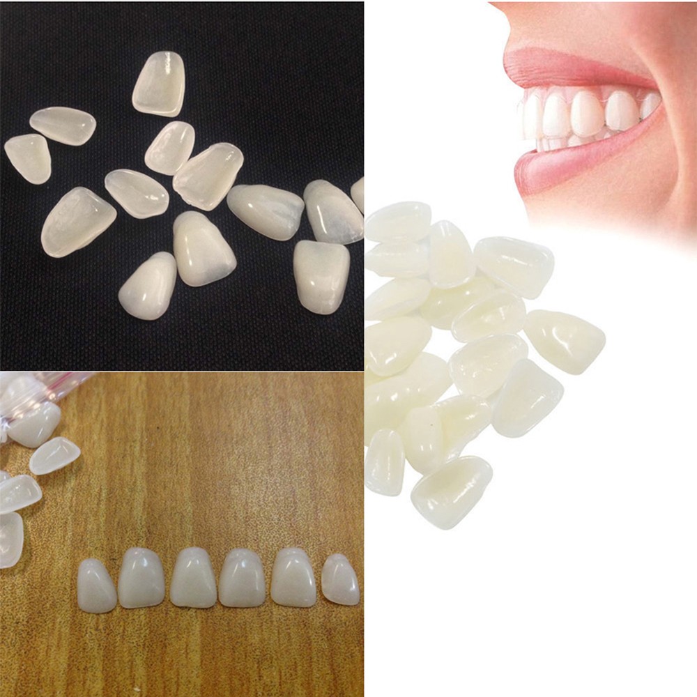 70 stuks/verpakking Beauty Ven - Teeth Whitening Veneers recensie en prijs