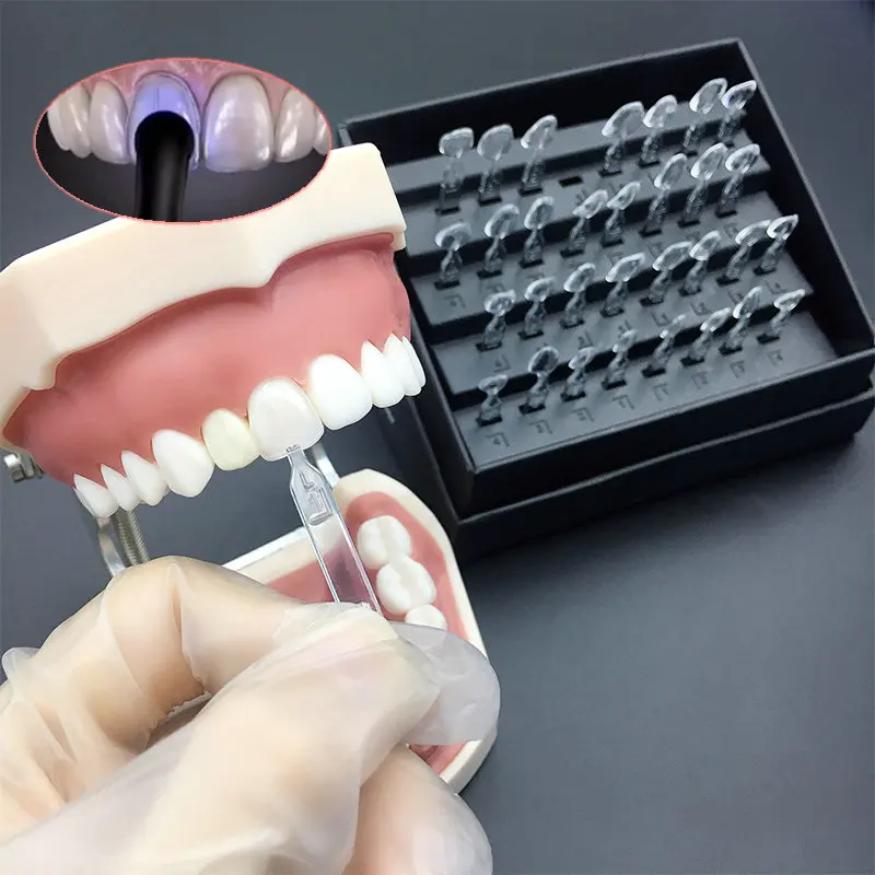 Tandheelkundige fineer mal aut - Teeth Whitening Veneers recensie en prijs